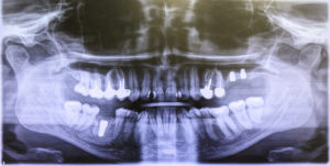 Facial Trauma Treatment in Conway, AR