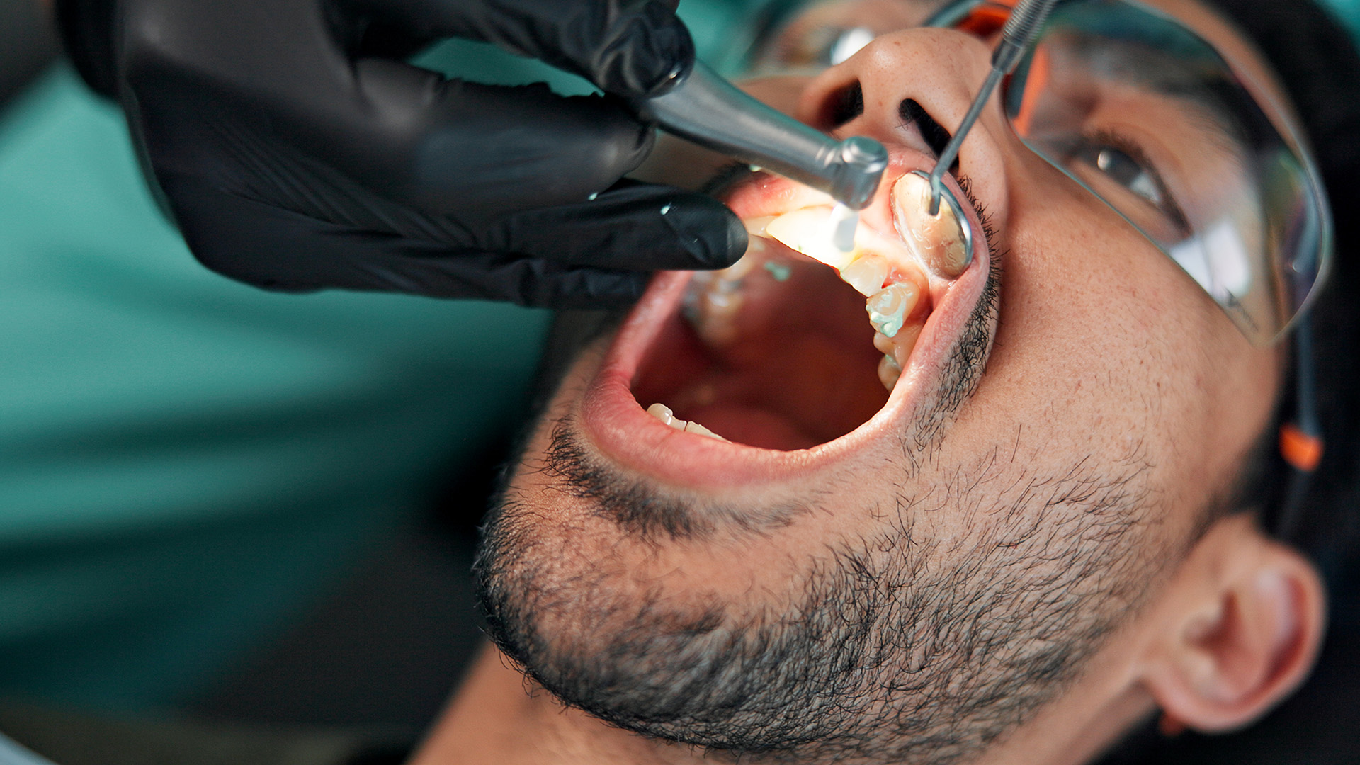 Oral Surgery Treatments