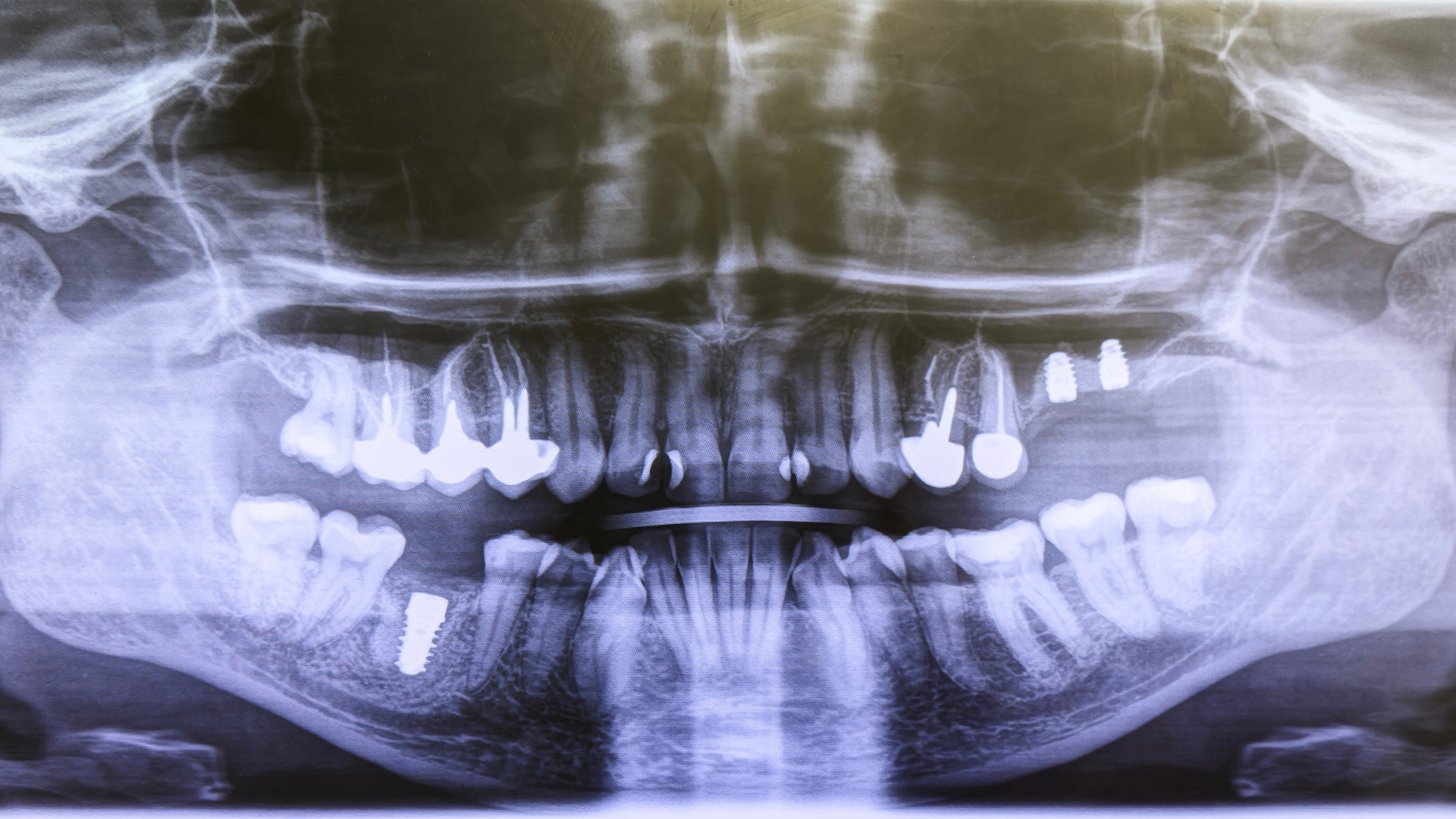 Facial Trauma Treatment in Russellville AR